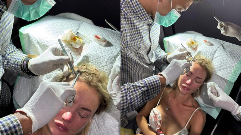 Модель из Казахстана задержана на Бали после обвинений блогера в нападении